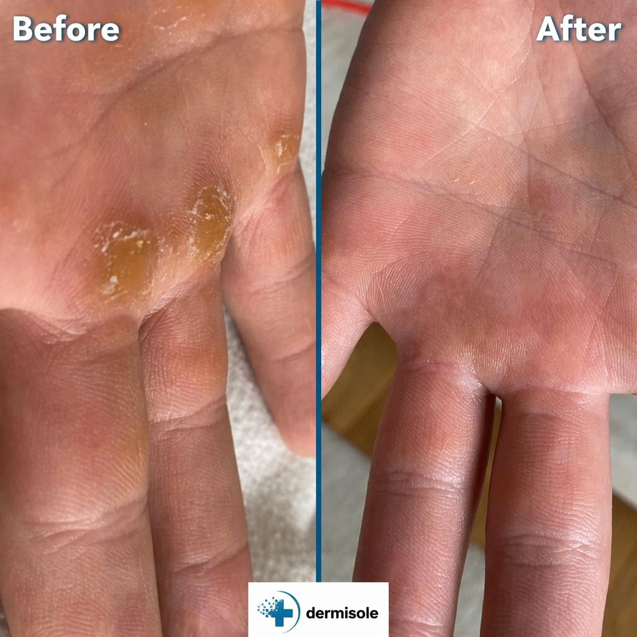 Dermisole-Hand&Foot Care