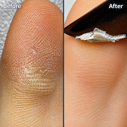 Dermisole-Hand&Foot Care